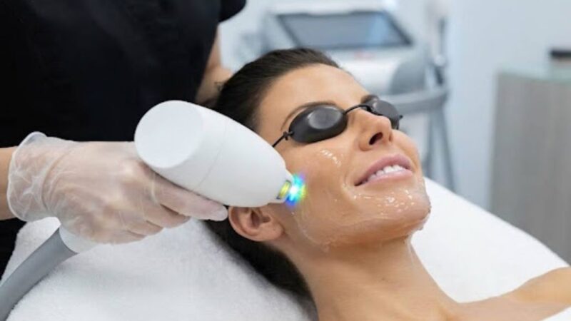 Everything You Need to Know About IPL Photofacial Treatment