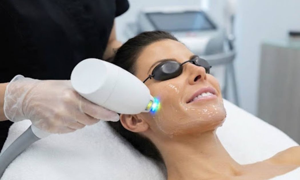 Everything You Need to Know About IPL Photofacial Treatment